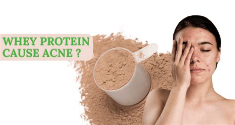 Will Whey Protein Cause Acne? And Why Do Bananas Glow in the Dark?